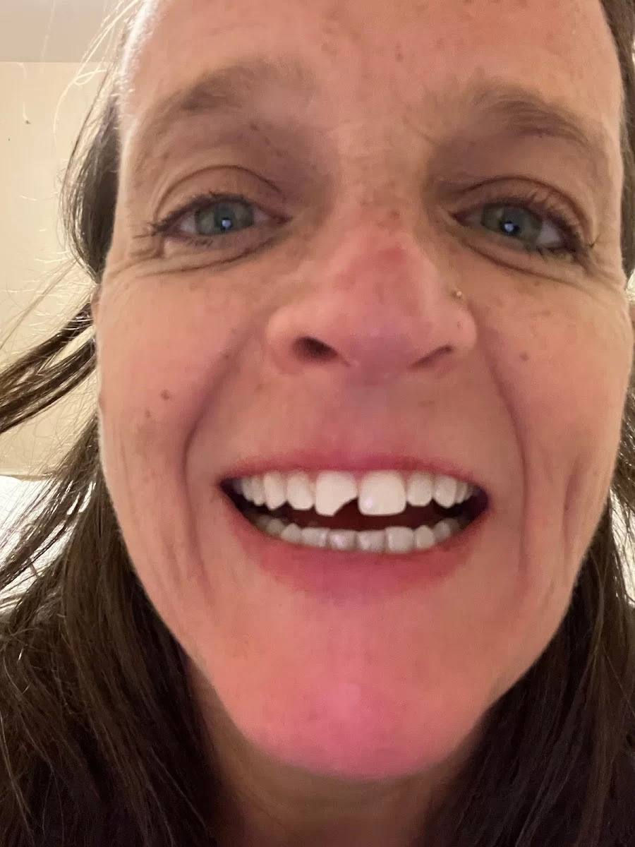 Ryerson Smiles Picture 4