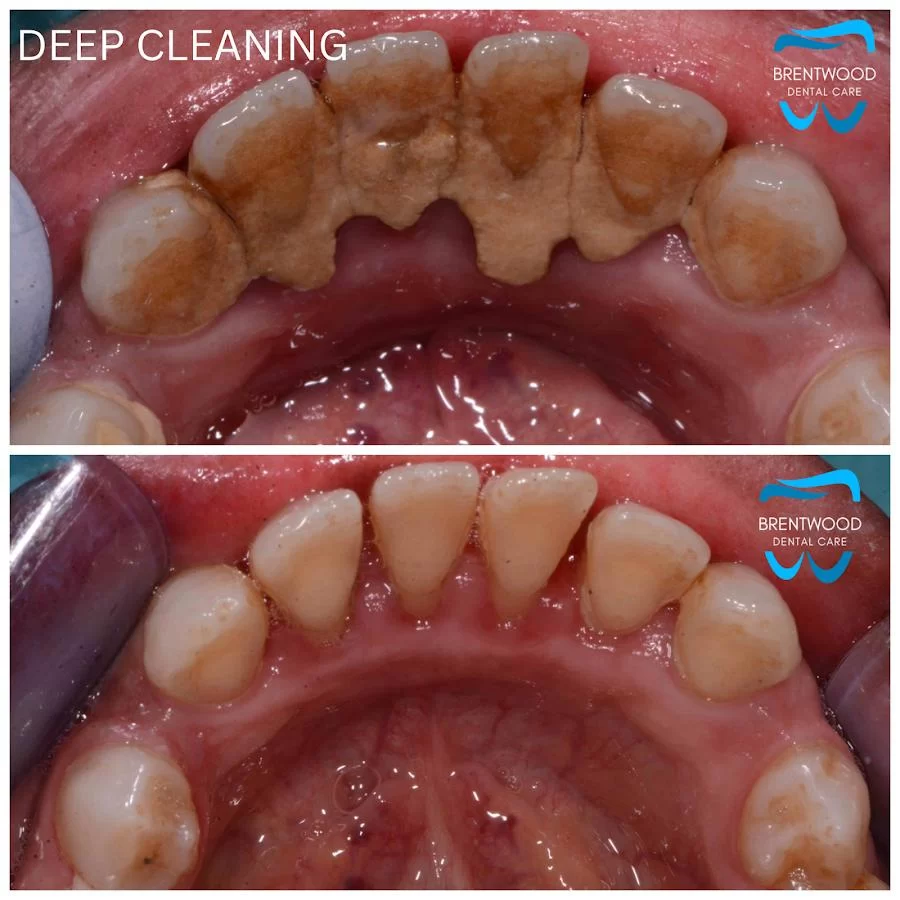 Brentwood Dental Care Picture 10