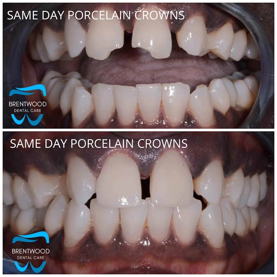 Brentwood Dental Care Picture 7