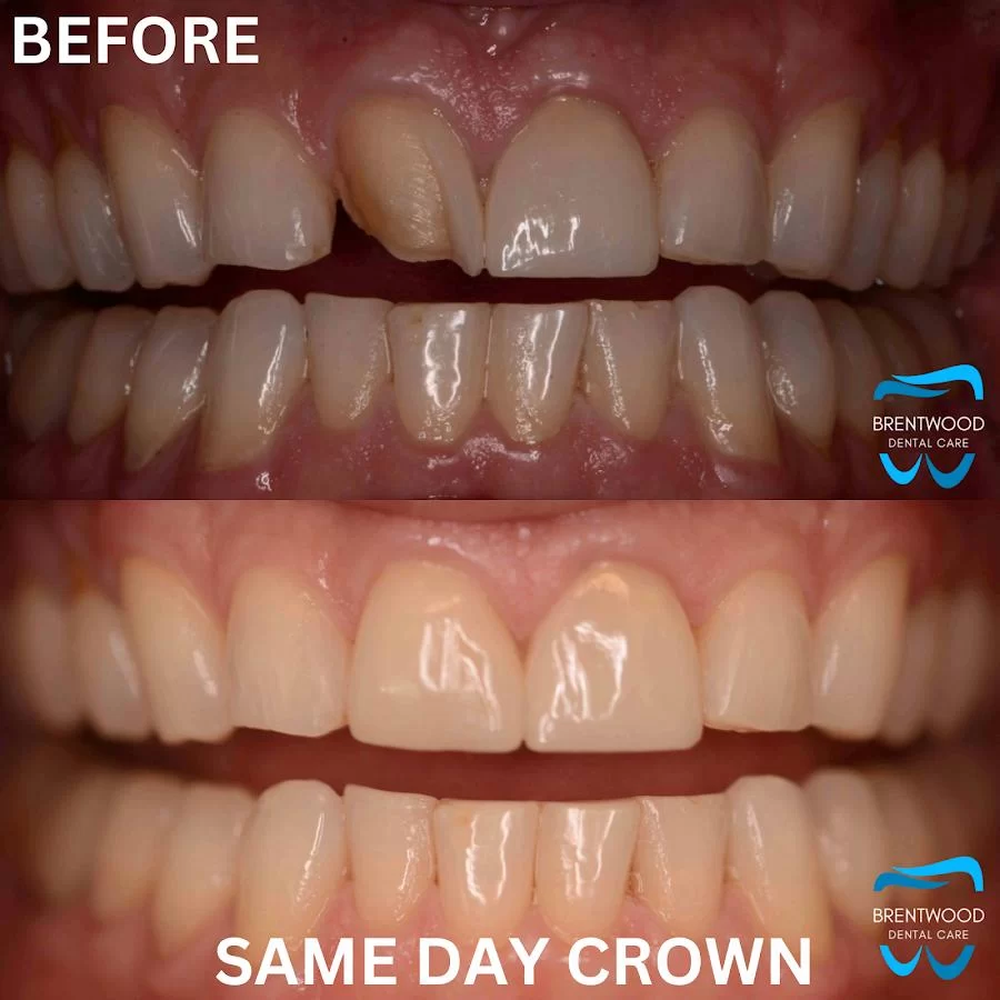 Brentwood Dental Care Picture 8