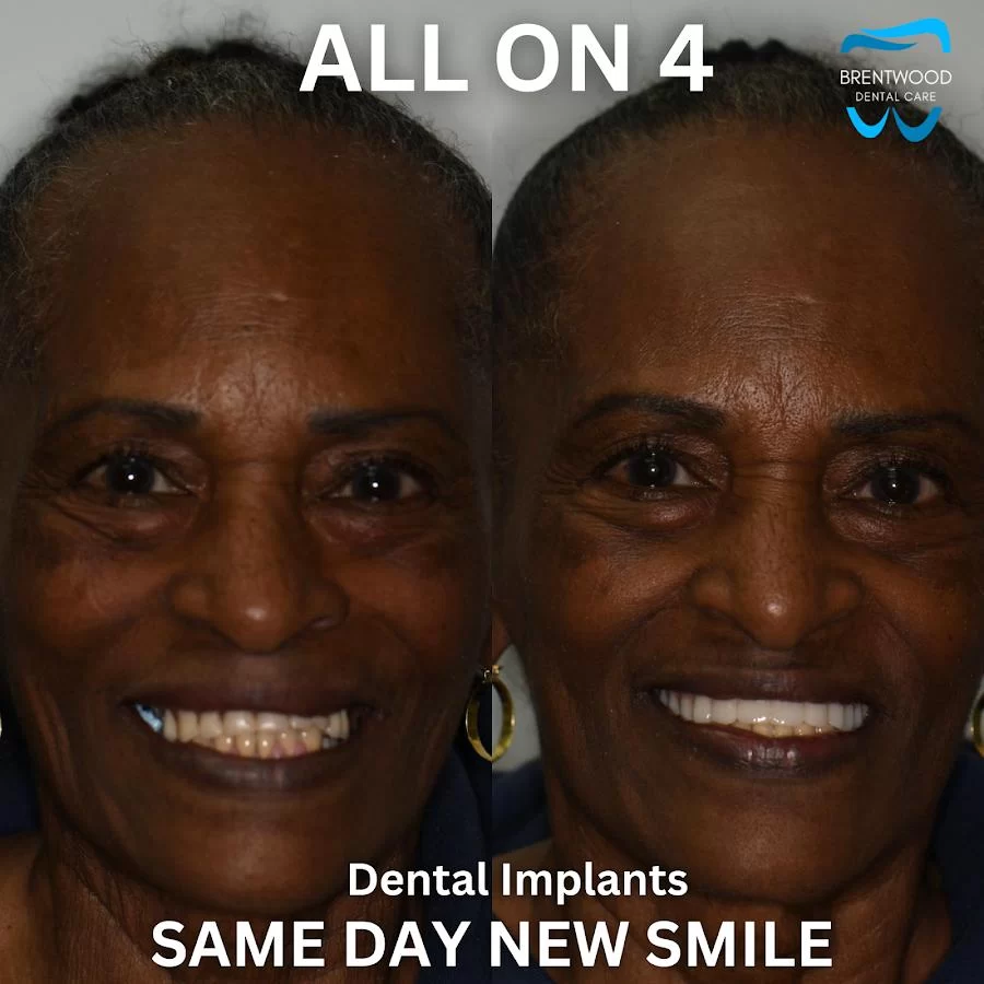 Brentwood Dental Care Picture 9