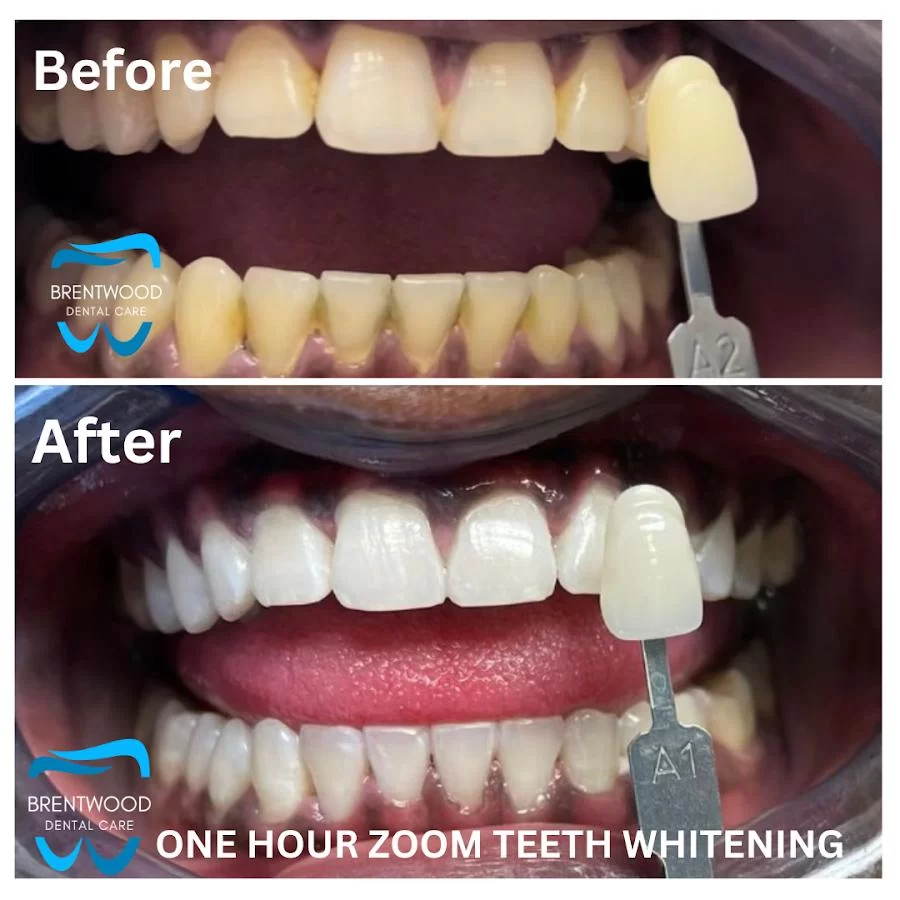 Brentwood Dental Care Picture 6