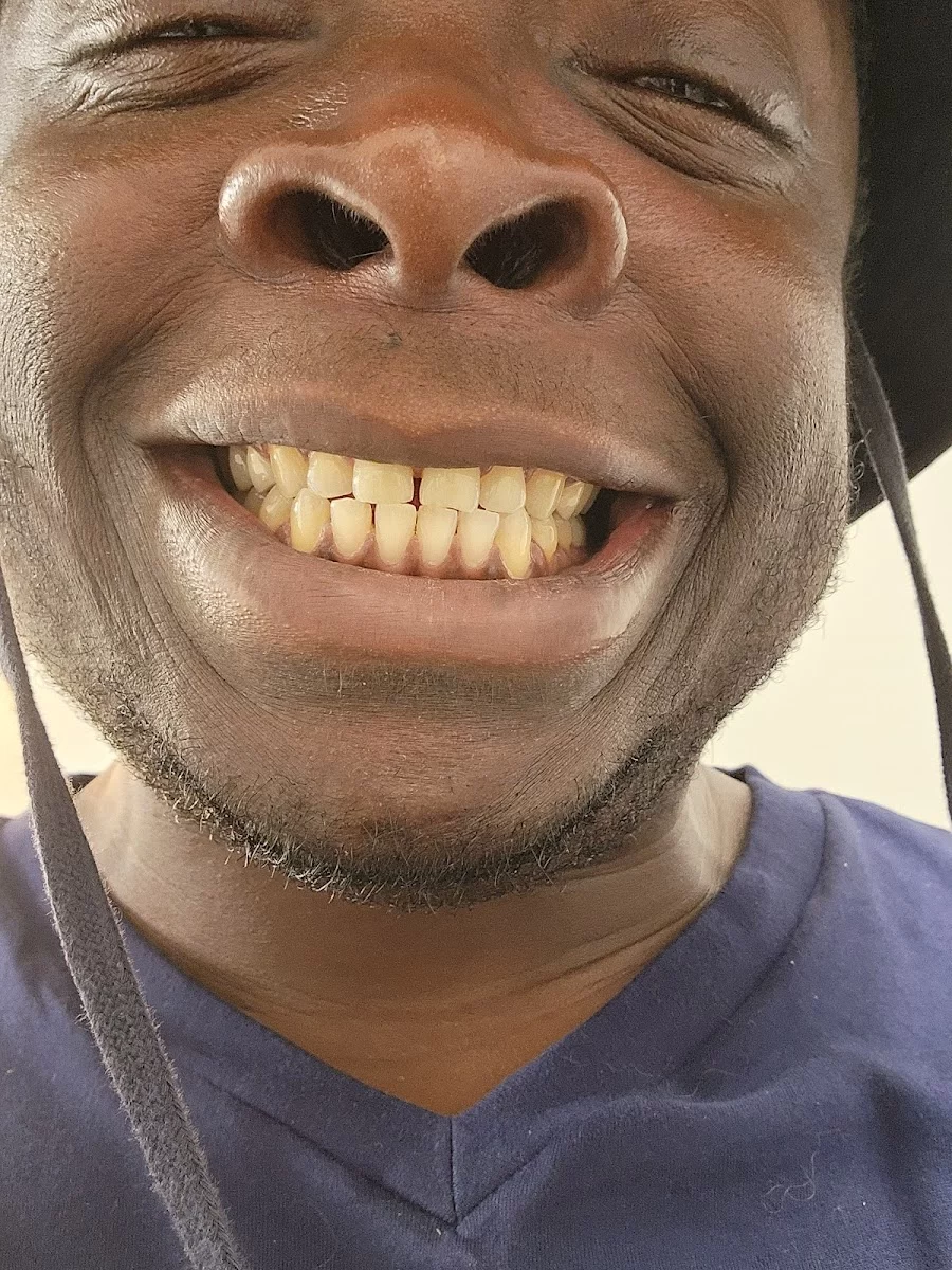 Smiling Molar Dental Picture 9