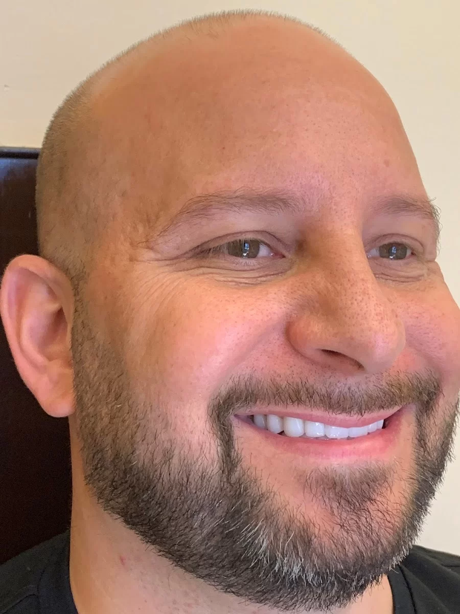 Sola Dental Spa: Cosmetic Dentists In New York, Dental Clinic Staten Island, NY Picture 10
