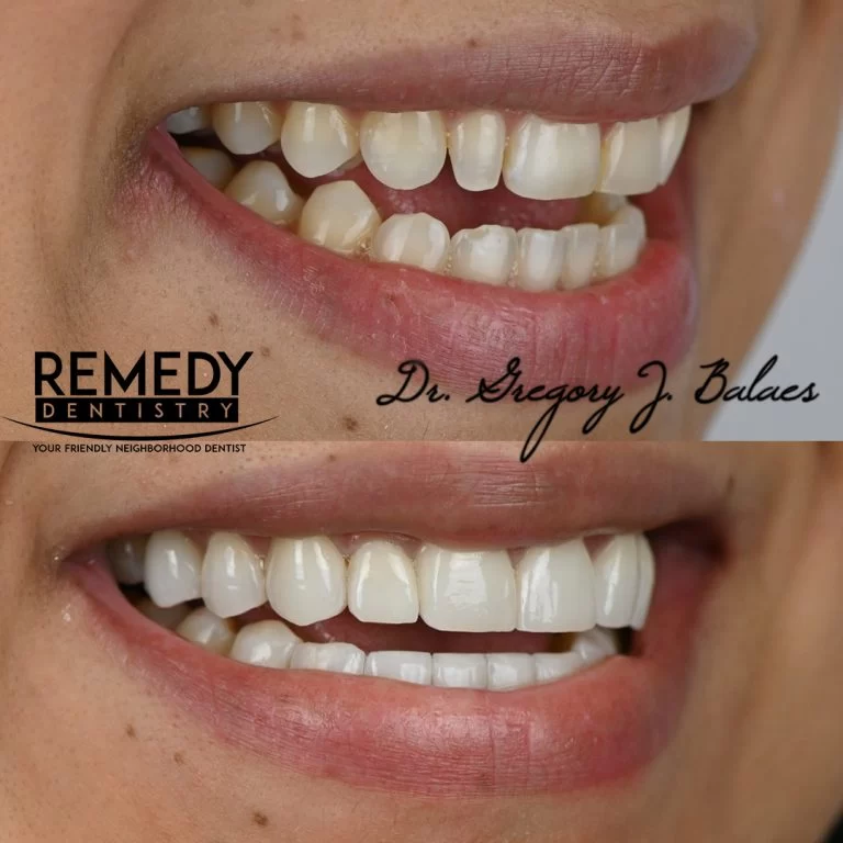 Remedy Dentistry: Comprehensive Cosmetic Dental Care Picture 7