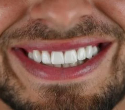 Remedy Dentistry: Comprehensive Cosmetic Dental Care Picture 4