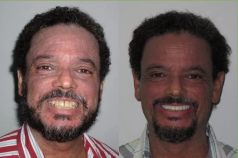 Staten Island Aesthetic & Implant Dentist Picture 3