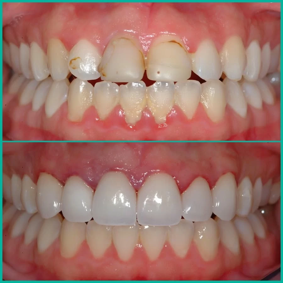 Smile Design NJ Picture 2