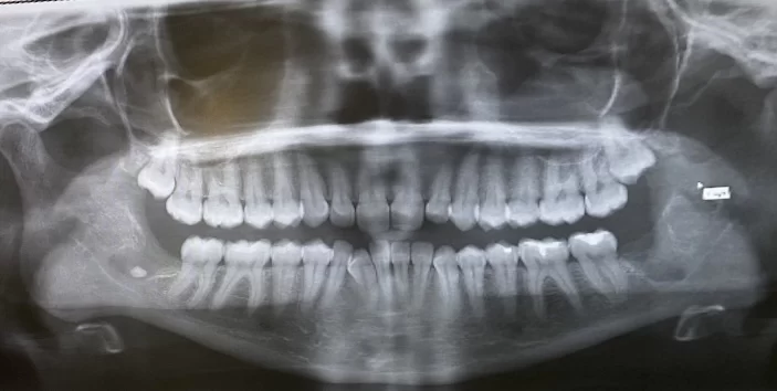 Beverly Hills Orthodontics Picture 2
