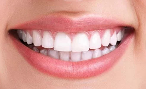 Creative Smiles Picture 1