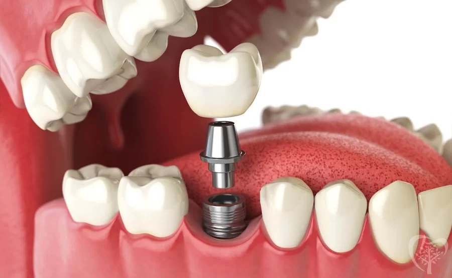 Newton Dentistry Picture 4