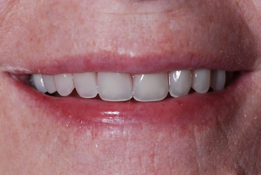 Jeffrey S. Cummings, DMD Picture 4