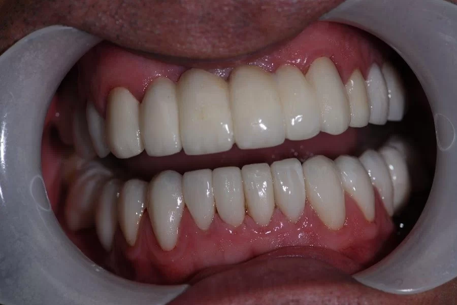 Jeffrey S. Cummings, DMD Picture 6