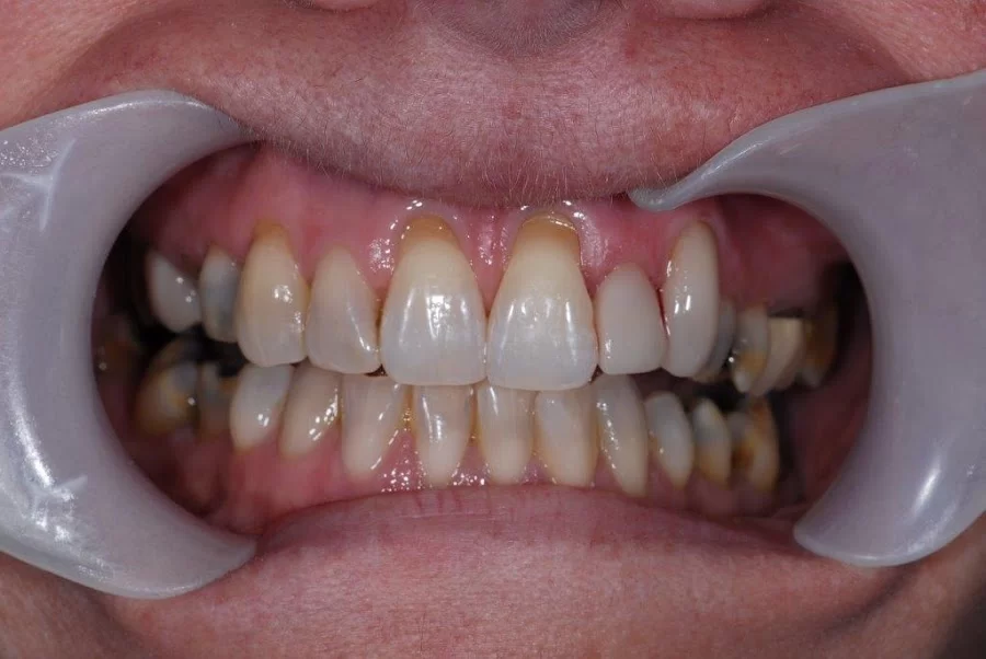 Jeffrey S. Cummings, DMD Picture 5