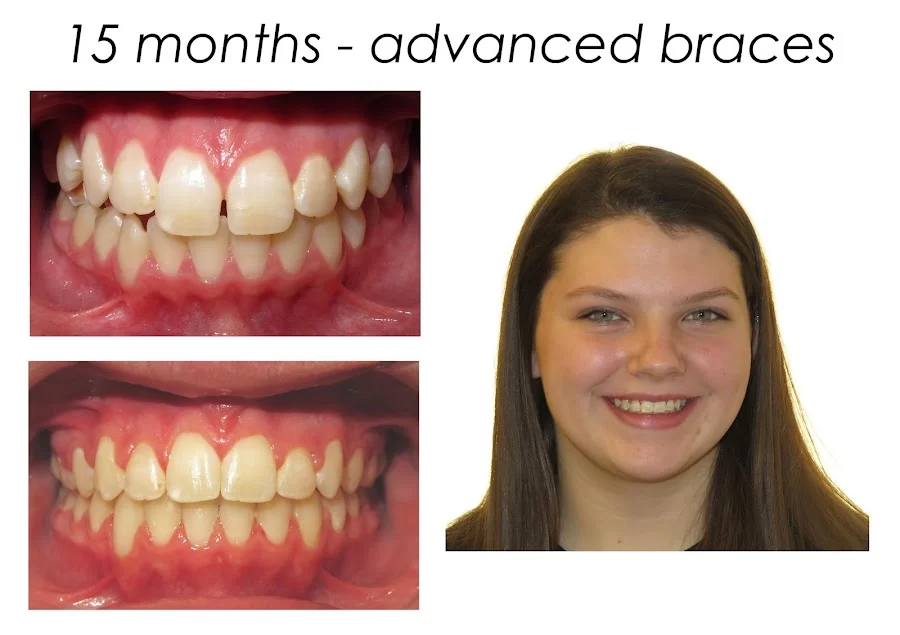 Henn Orthodontics Picture 2