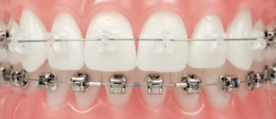 Henn Orthodontics Picture 1