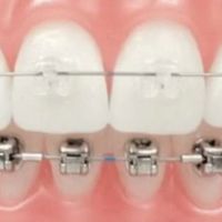 Henn Orthodontics ico