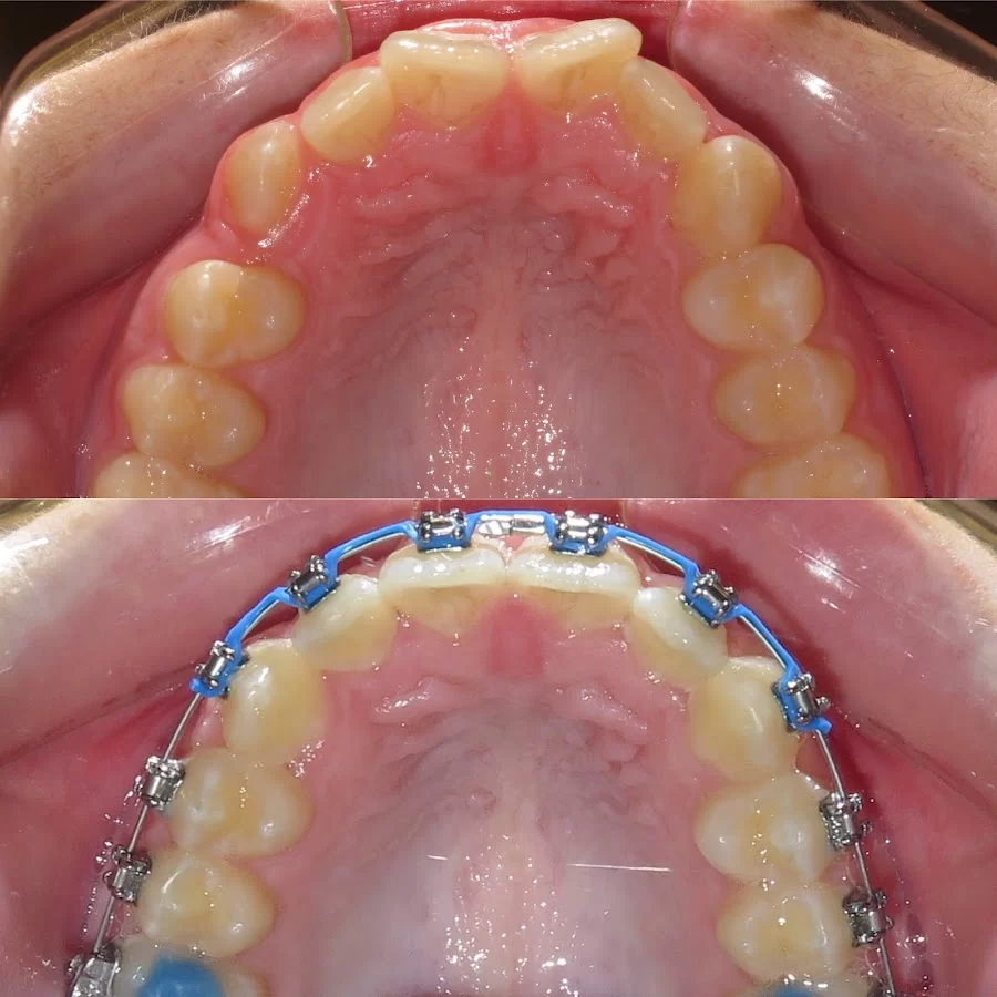 Henn Orthodontics Picture 8