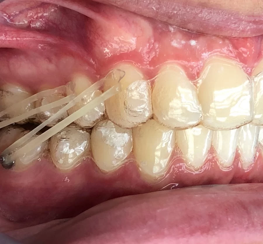 Henn Orthodontics Picture 6