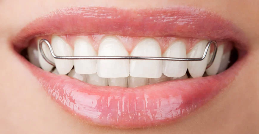 Ernstberger Orthodontics Picture 1