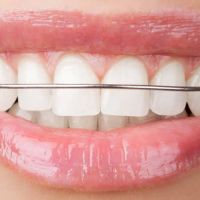 Ernstberger Orthodontics ico