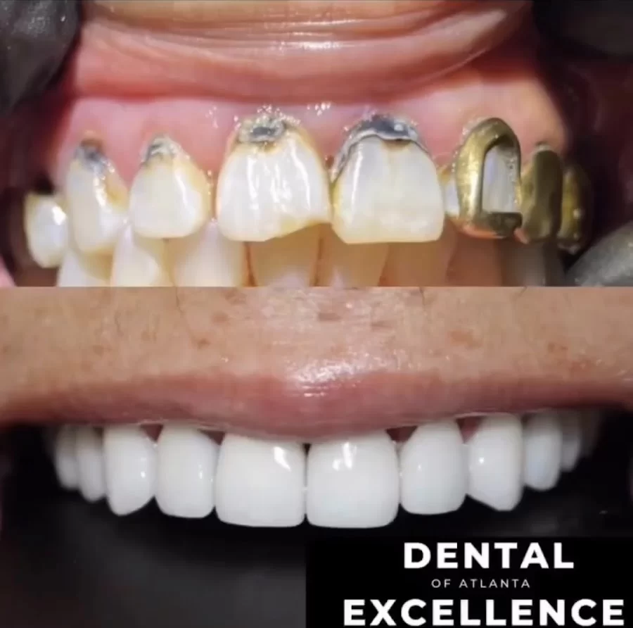 Dental Excellence of Atlanta Picture 2
