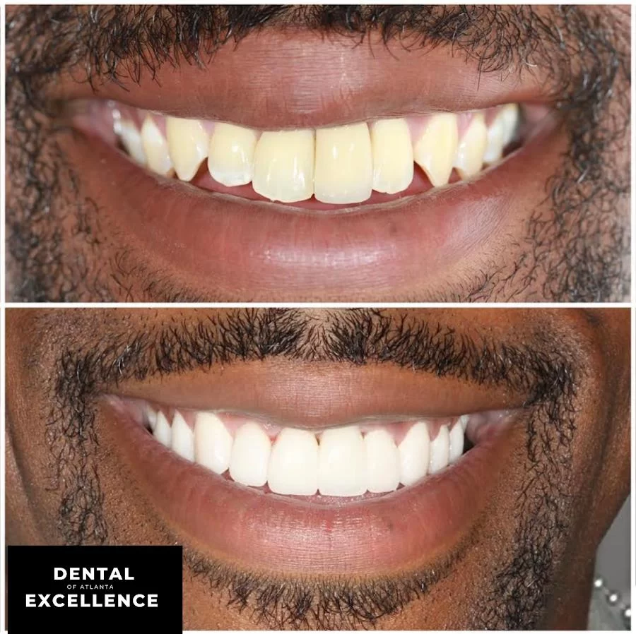 Dental Excellence of Atlanta Picture 8
