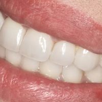Imperial Smile Dentistry ico