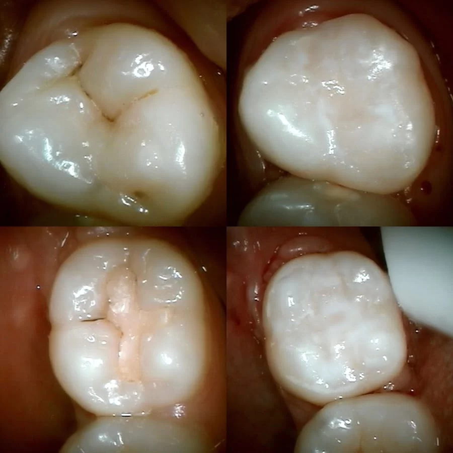 Blessed Smile Dentistry of Yorba Linda Picture 6