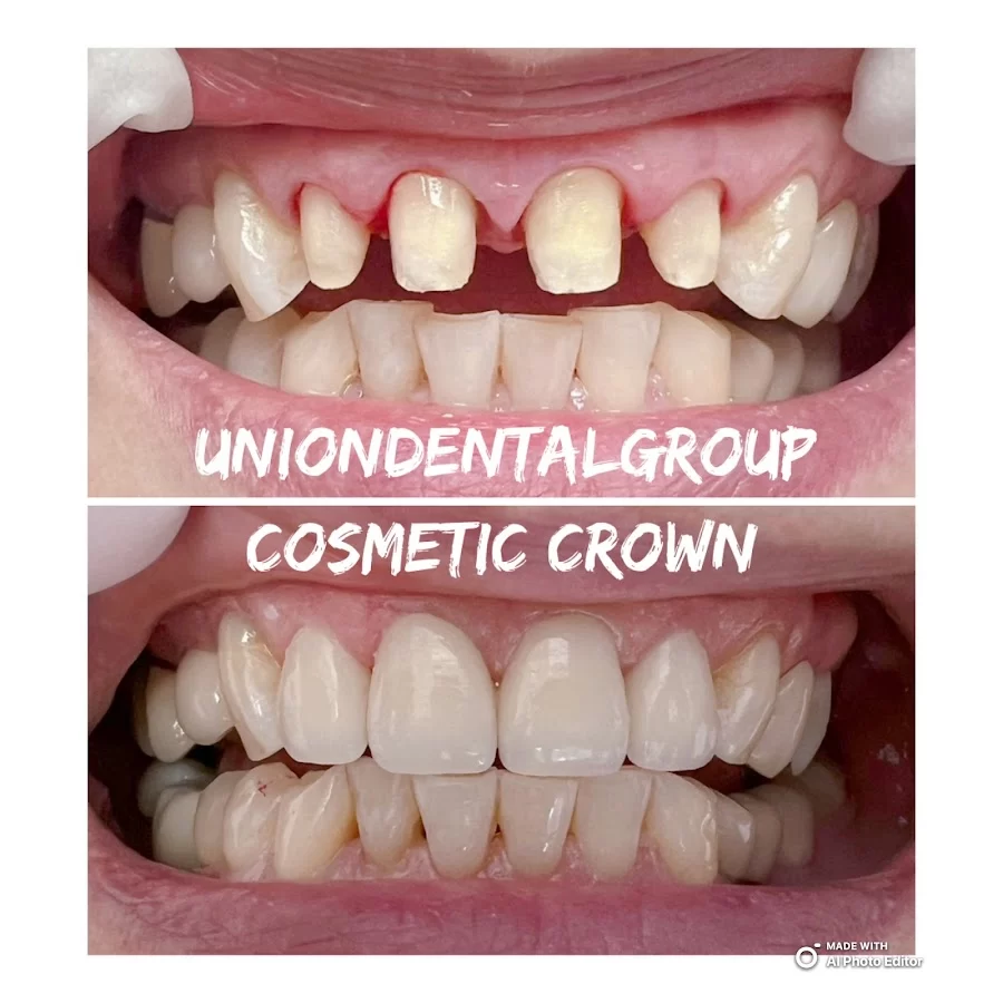 Union Dental Garden grove office Picture 4
