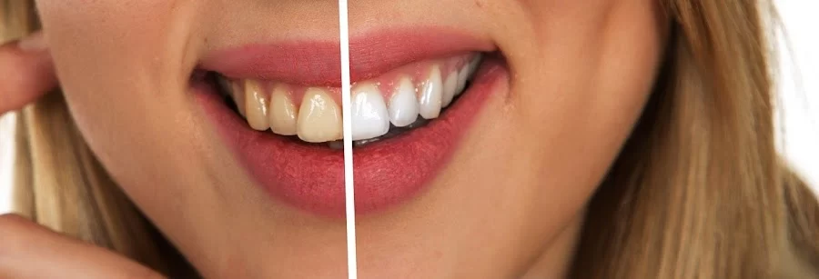 El Camino Dental Picture 1