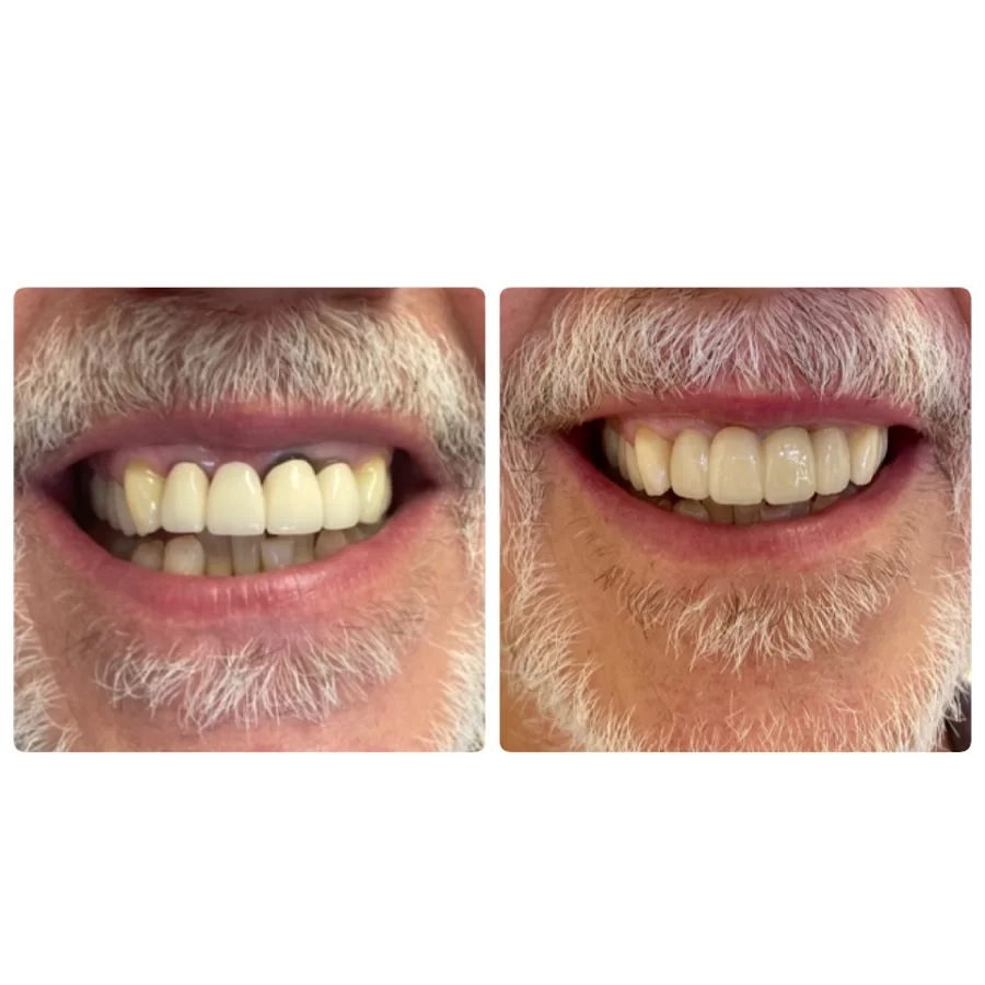 Long Beach Dental Studio: Dr. Jasmine Minasyan Picture 8