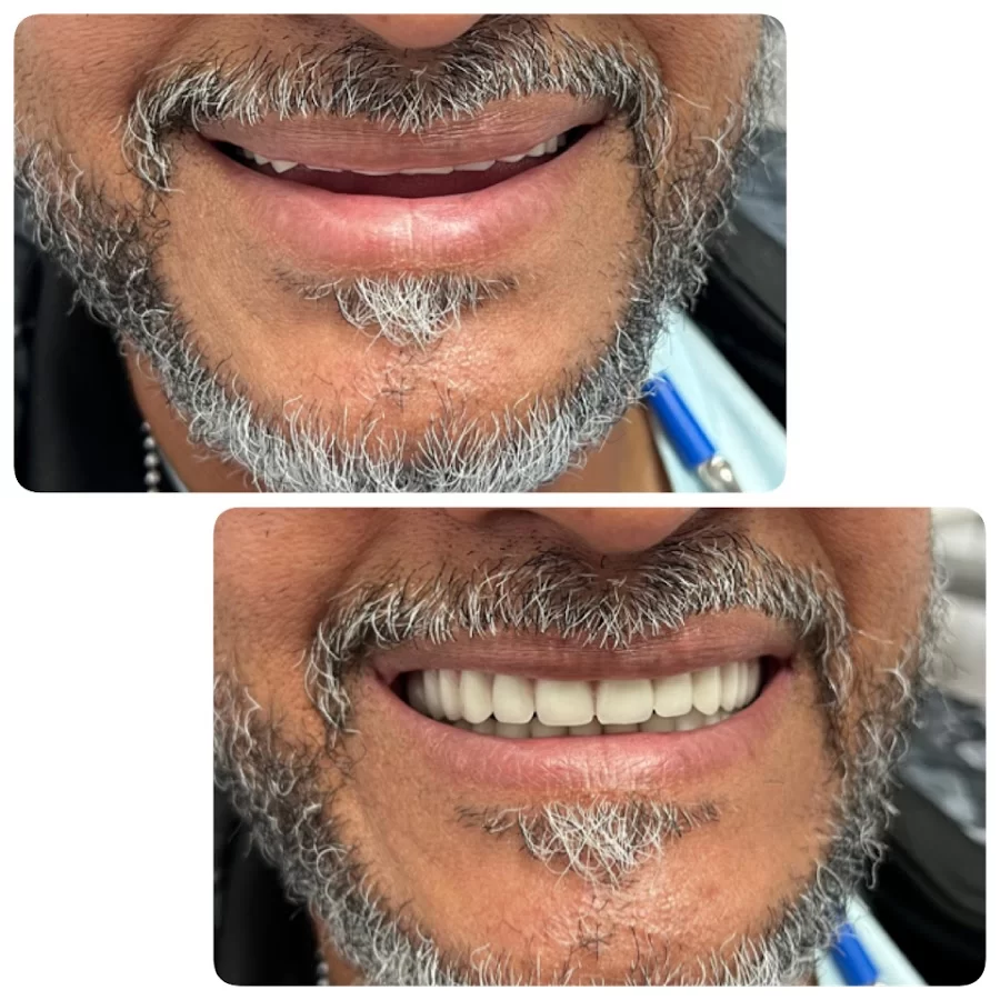 Long Beach Dental Studio: Dr. Jasmine Minasyan Picture 10