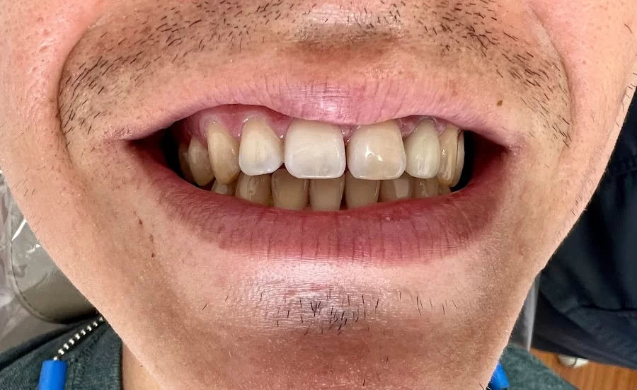 Long Beach Dental Studio: Dr. Jasmine Minasyan Picture 7