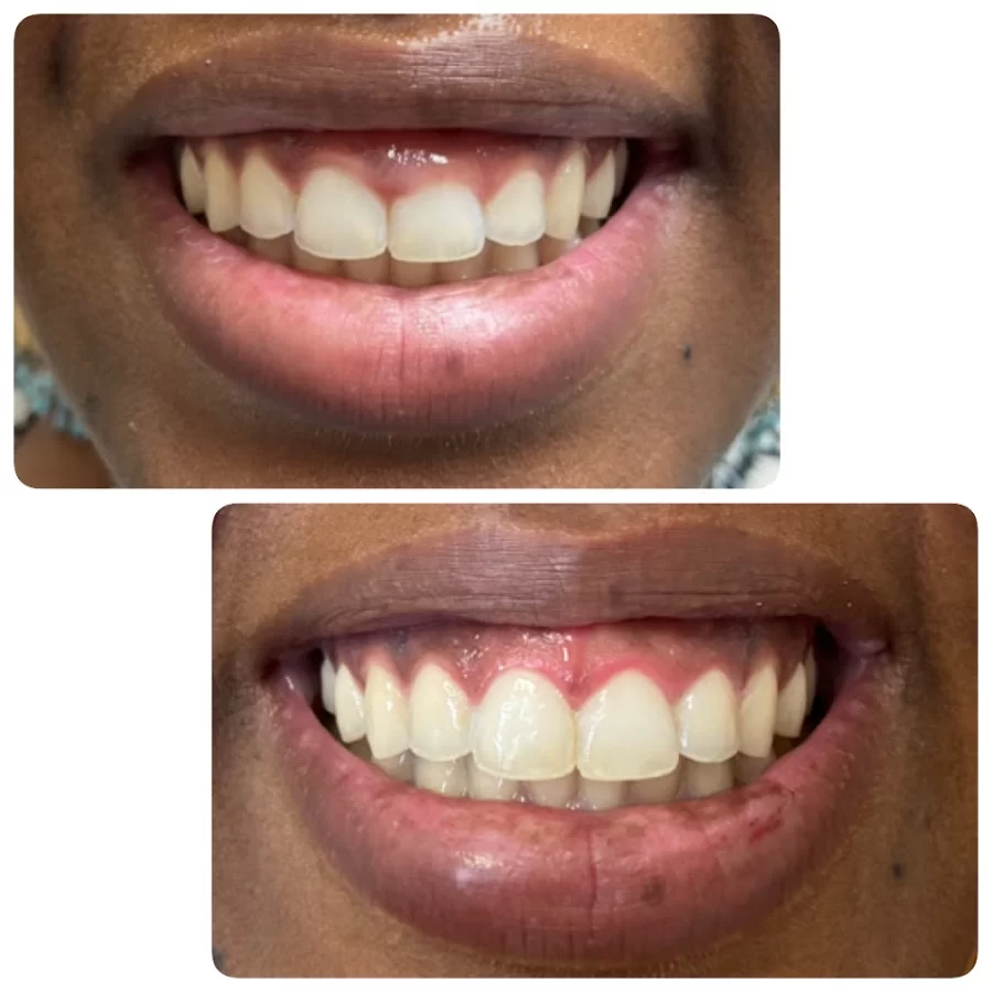 Long Beach Dental Studio: Dr. Jasmine Minasyan Picture 9