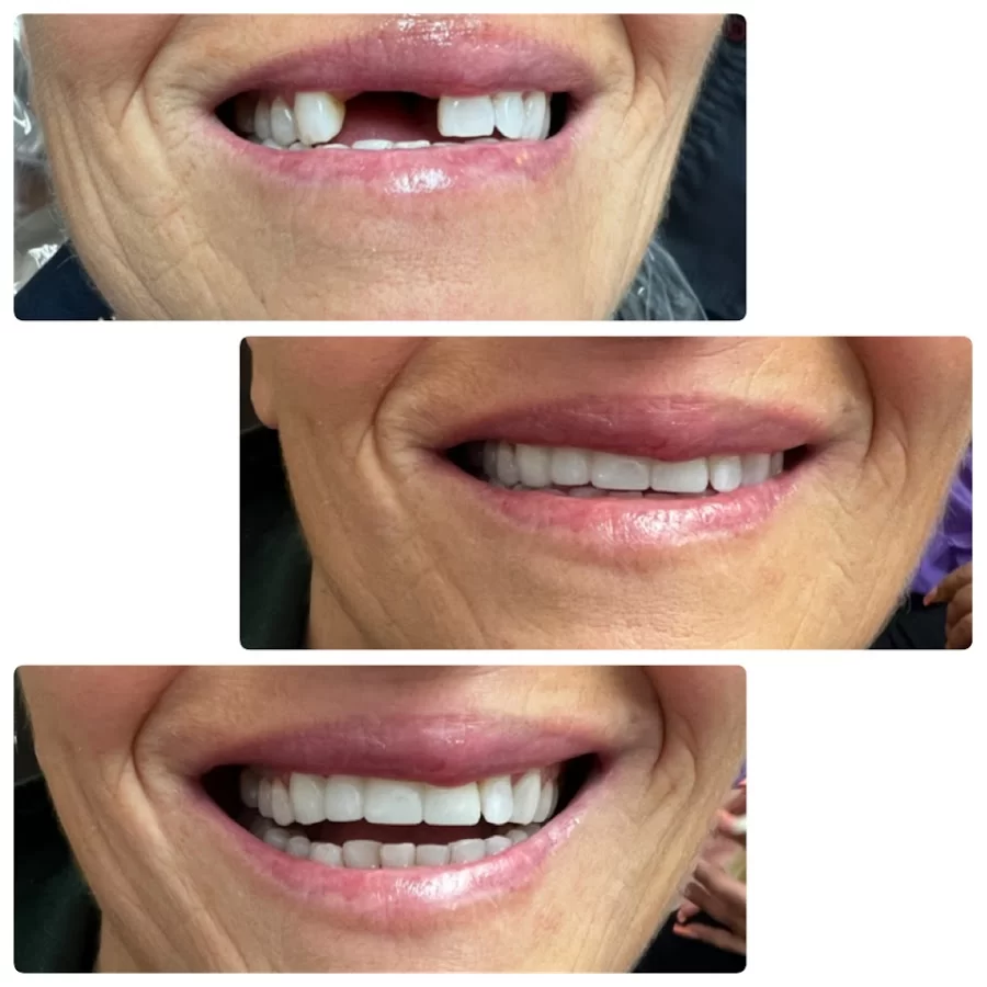 Long Beach Dental Studio: Dr. Jasmine Minasyan Picture 2
