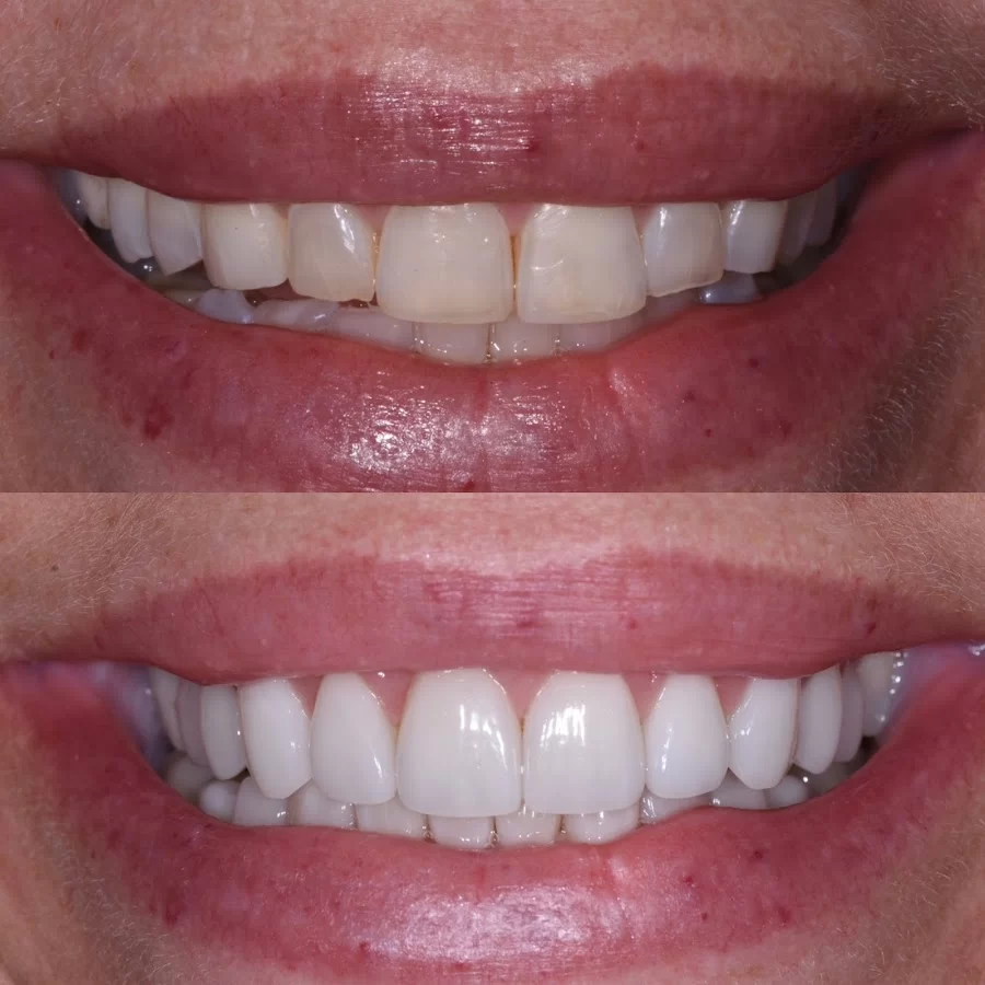 Beverly Hills Dentistry Picture 3