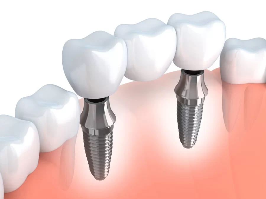 Bismarck Advanced Dental and Implants Picture 1