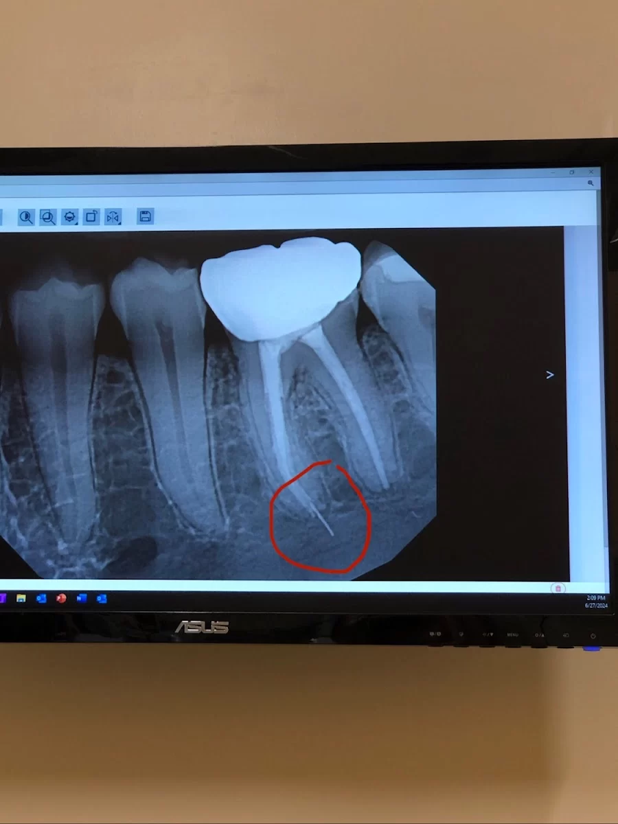 Listiyo Family Dental - Dentist Long Beach Picture 2