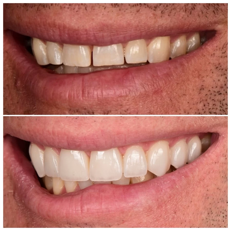 Asaro Dental Aesthetics Picture 6