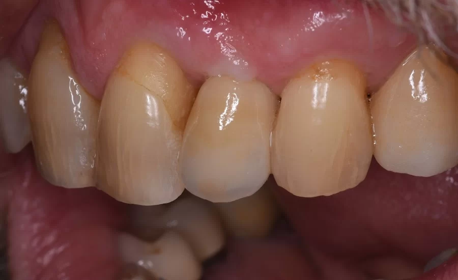 The Palisades Dentists Picture 3