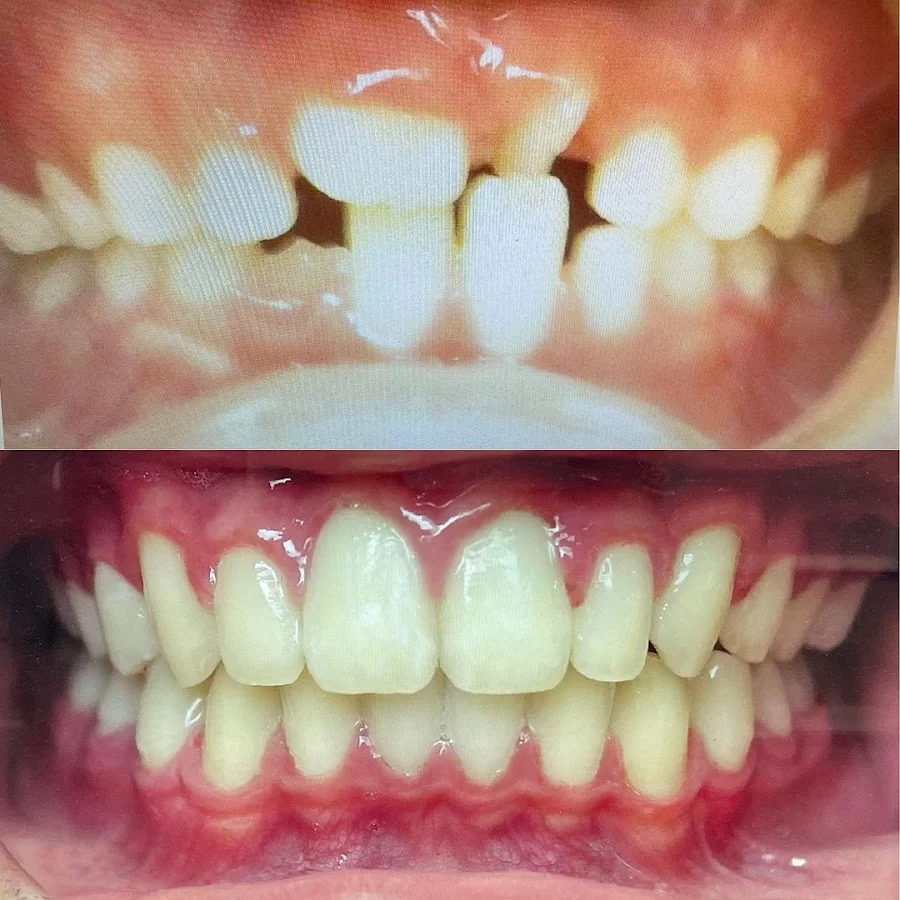 Abari Orthodontics and Oral Surgery - San Dimas Picture 6