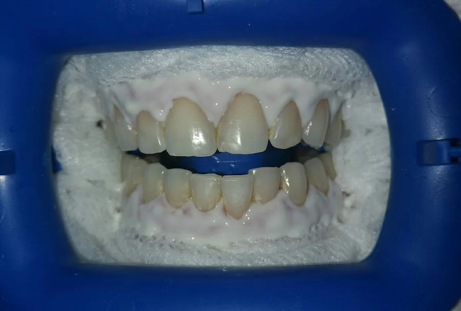 Dentistry by Dr. Doshi Picture 5