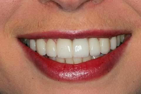 Joseph Sarkissian DDS Picture 3