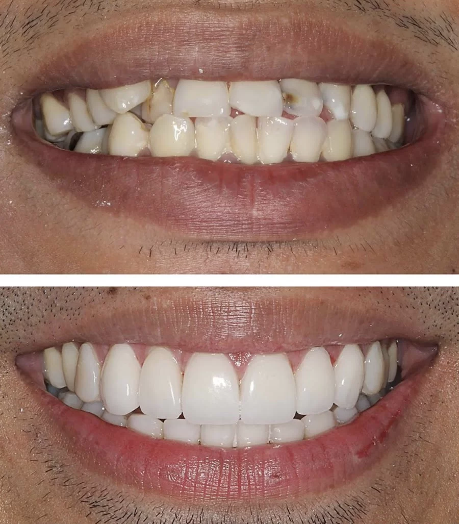 A Briter Smile dental group Picture 7