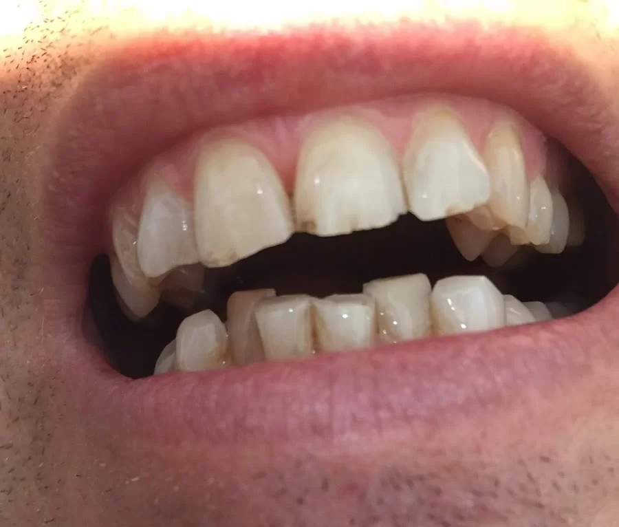Cosmetic Dentistry of Atlanta Picture 5
