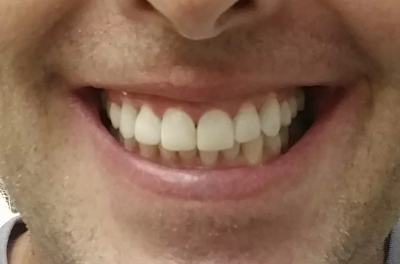 Cosmetic Dentistry of Atlanta Picture 3