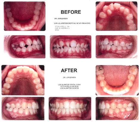 Jorgensen Orthodontics Picture 1