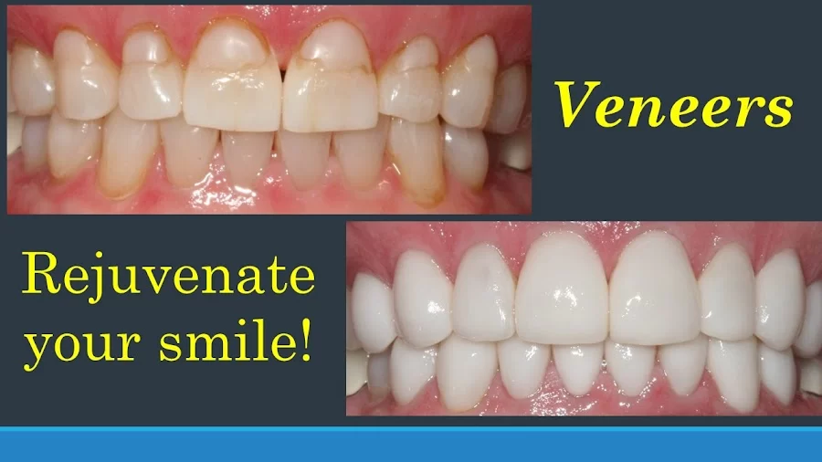 Smiles in Buckhead/Kendra Derrick, DDS Picture 3