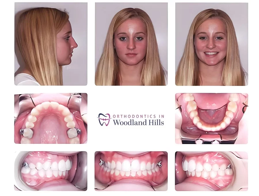 Orthodontics in Woodland Hills Picture 5